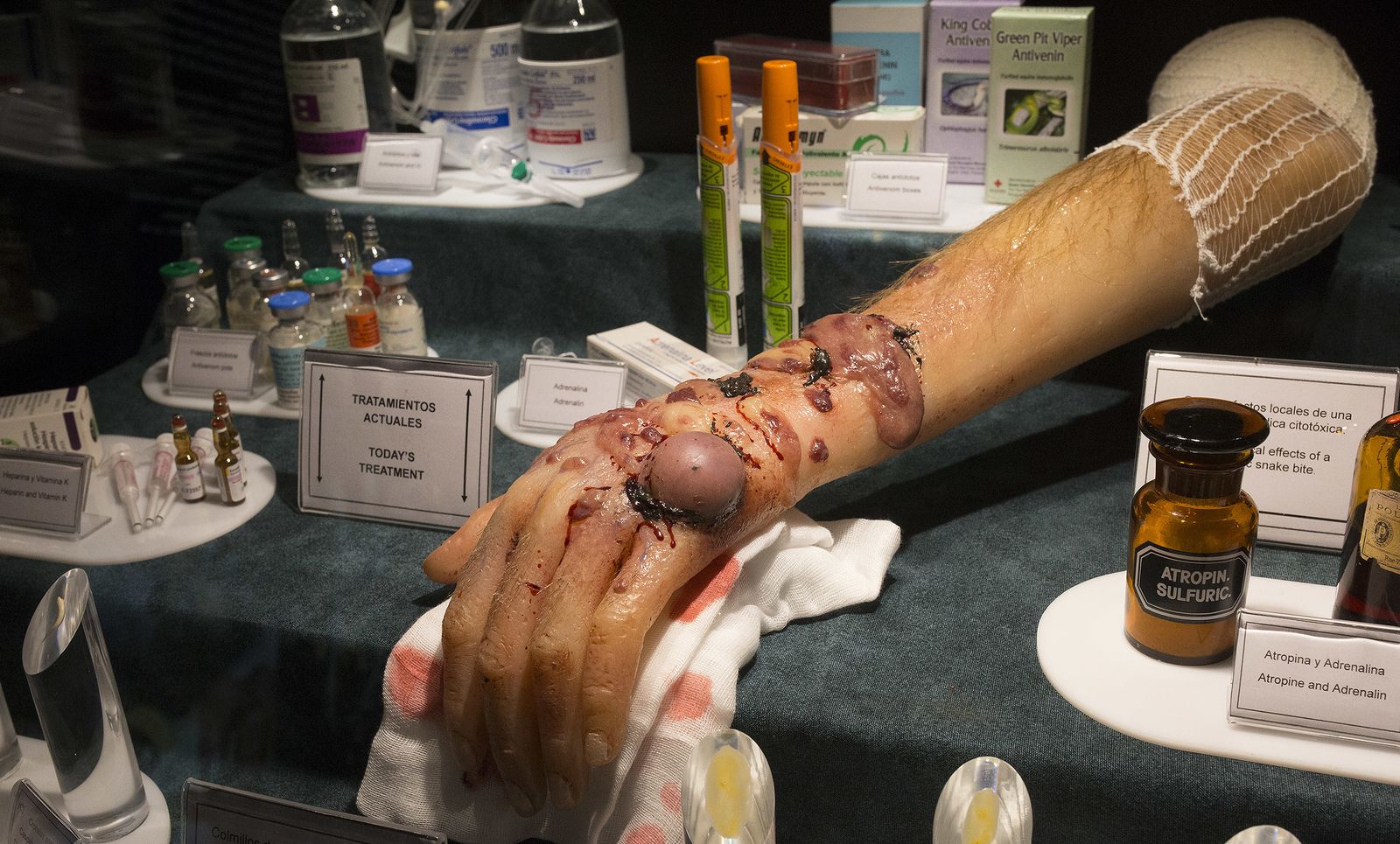 Simulación de mano afectada por veneno.