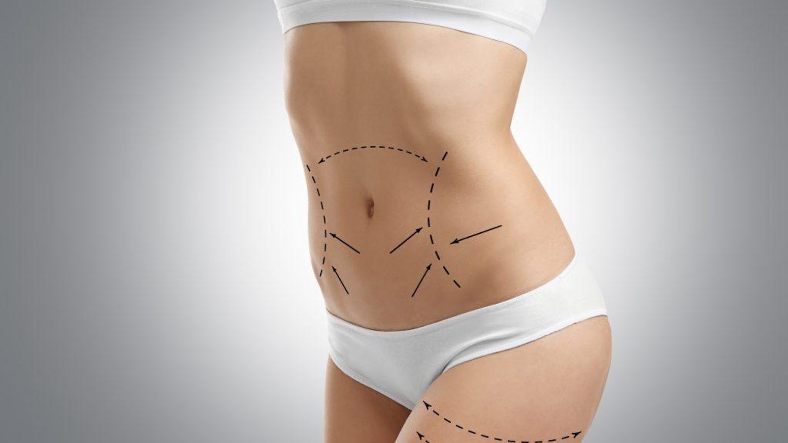La lipoescultura: secretos de la cirugía de moda para tener abdominales instantáneos