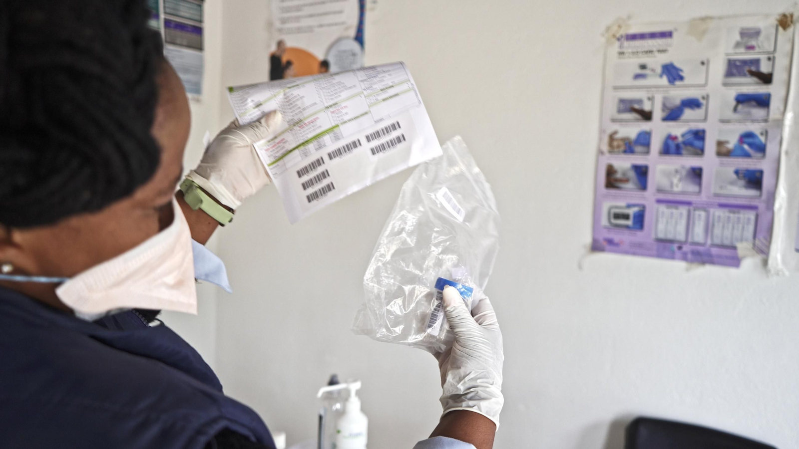Comprobación de un kit diagnóstico de tuberculosis en un centro sanitario en Sudáfrica.