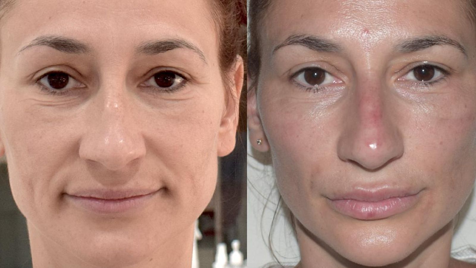 Técnicas de embellecimiento donde se deja patente la diferencia del antes y el después.