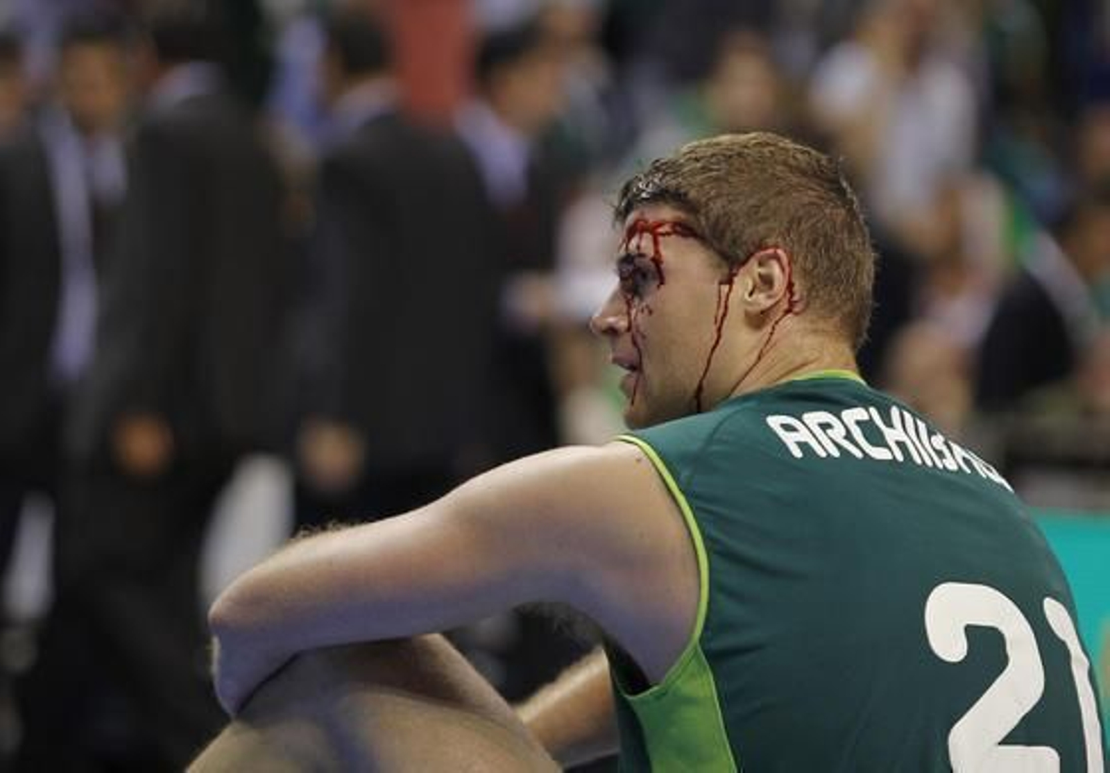 Archibald, ensagrentado tras un golpe. / Sergio Camacho