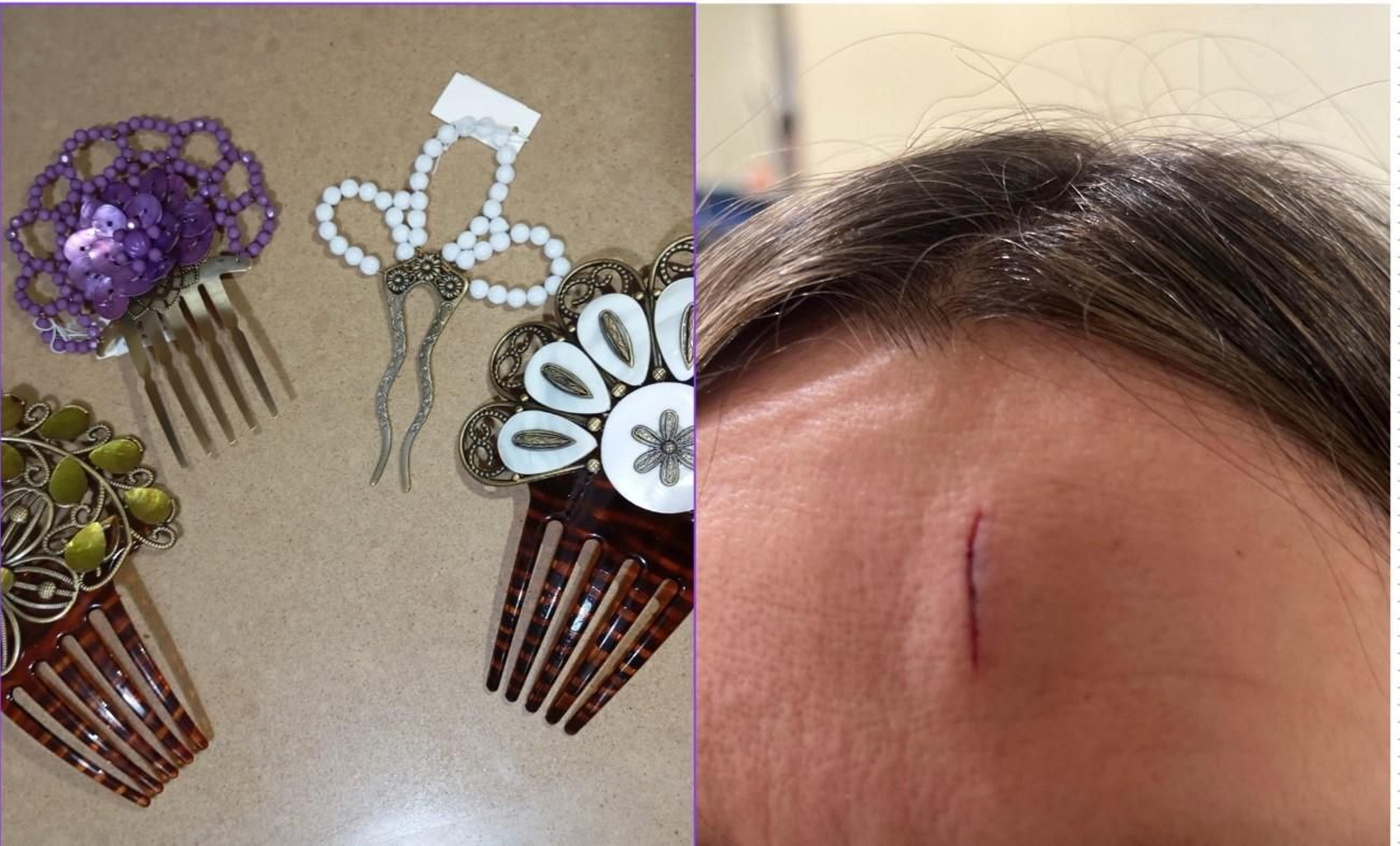 Lesiones tras la Cabalgata de Reyes de Utrera