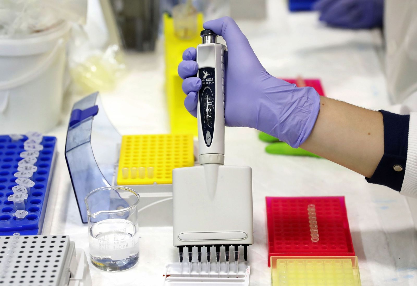 Laboratorio donde trabajan en un método de cribado no invasivo que mejora la detección precoz del cáncer de colon.