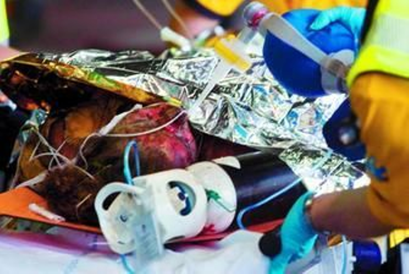 Uno de los heridos del accidente de ayer en Barajas.