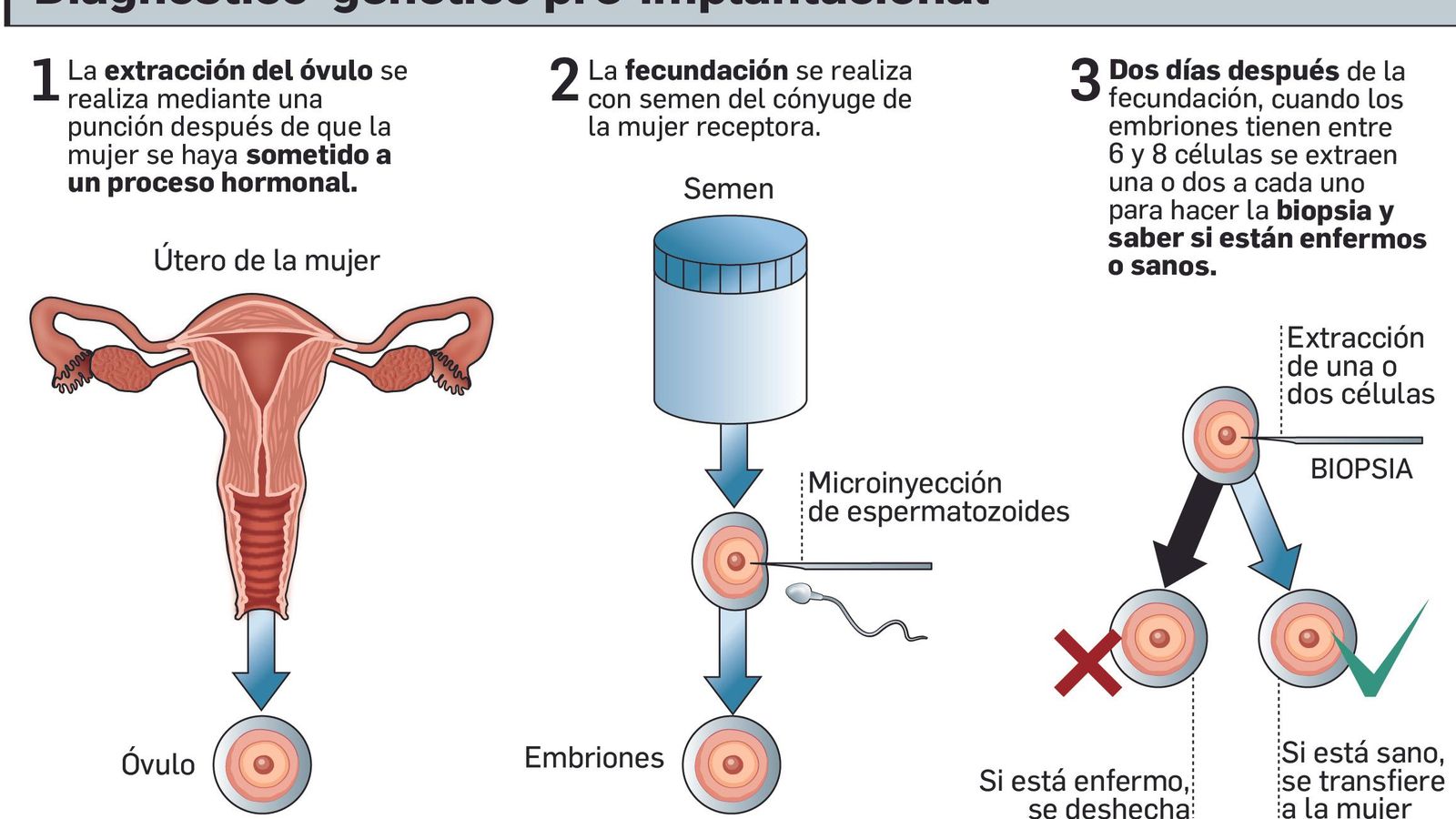 Infografía del diagnostico genético preimplantacional.