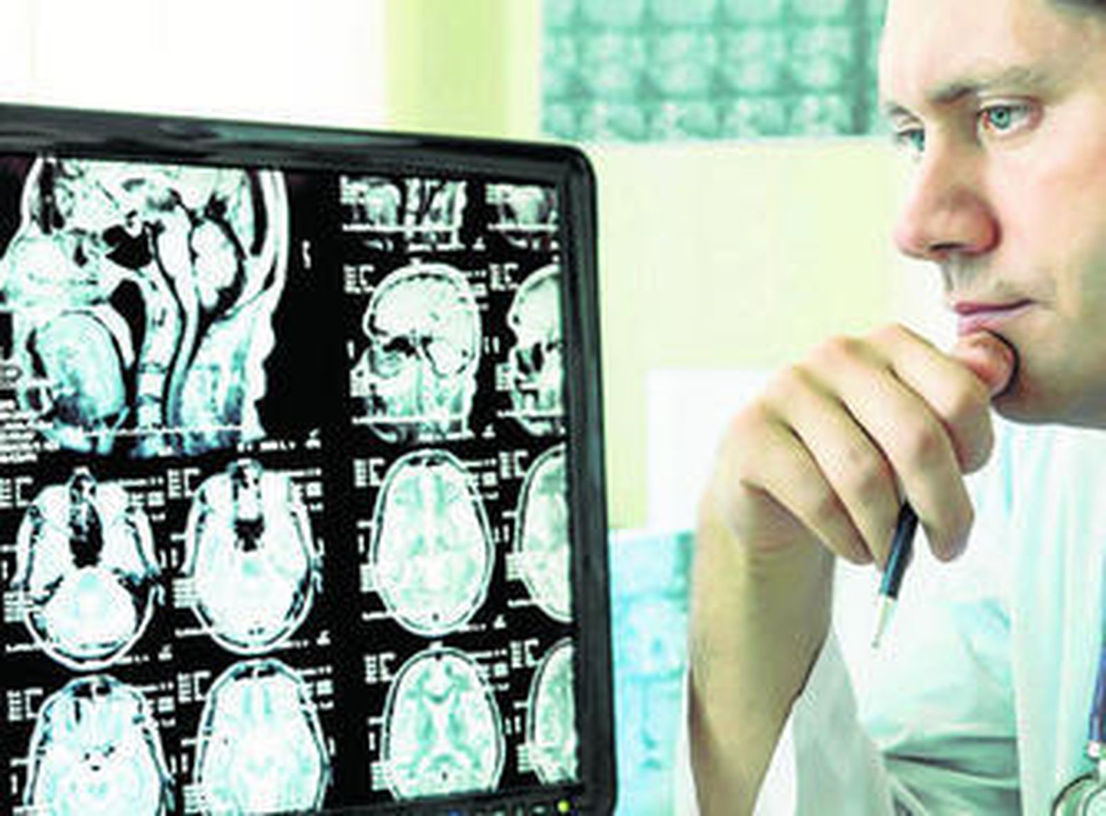 Los investigadores constataron mejoras en la discapacidad neurológica.