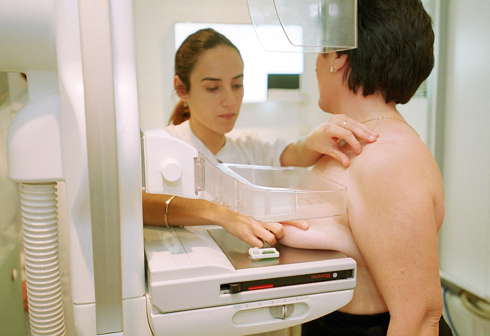 Una mujer se somete a una mamografía