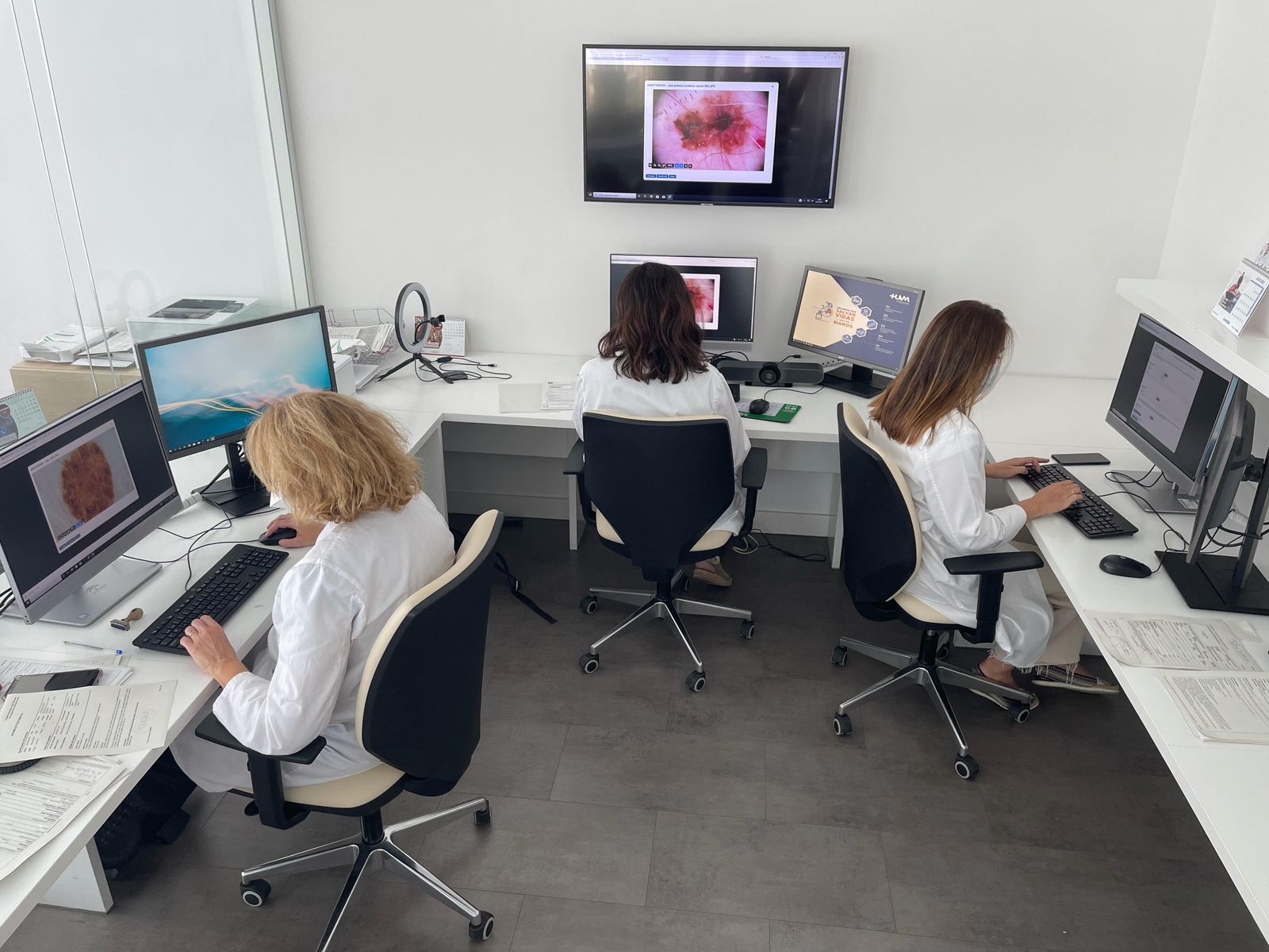 Muchos melanomas se detectan a través de las consultas por teledermatología