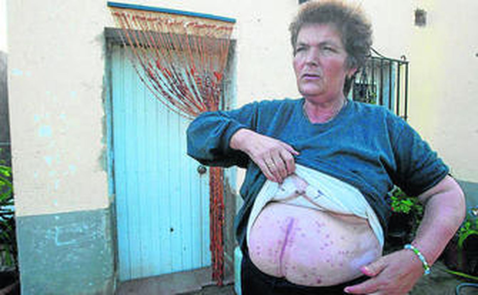 La madre de Tamara, mostrando las heridas que ella sufrió también.