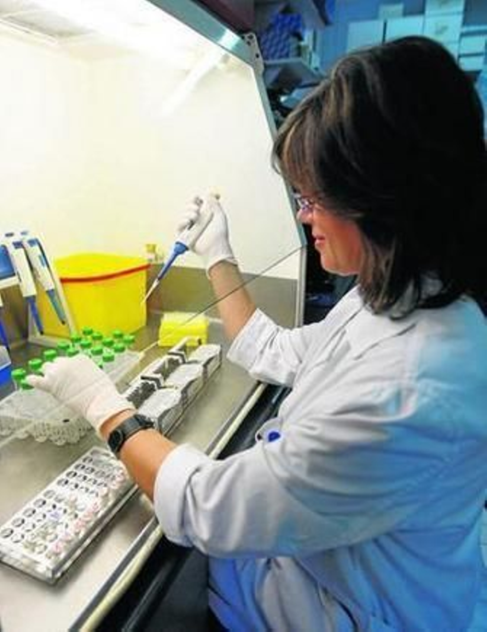 El laboratorio de Microbiología de Granada es referente para las pruebas.