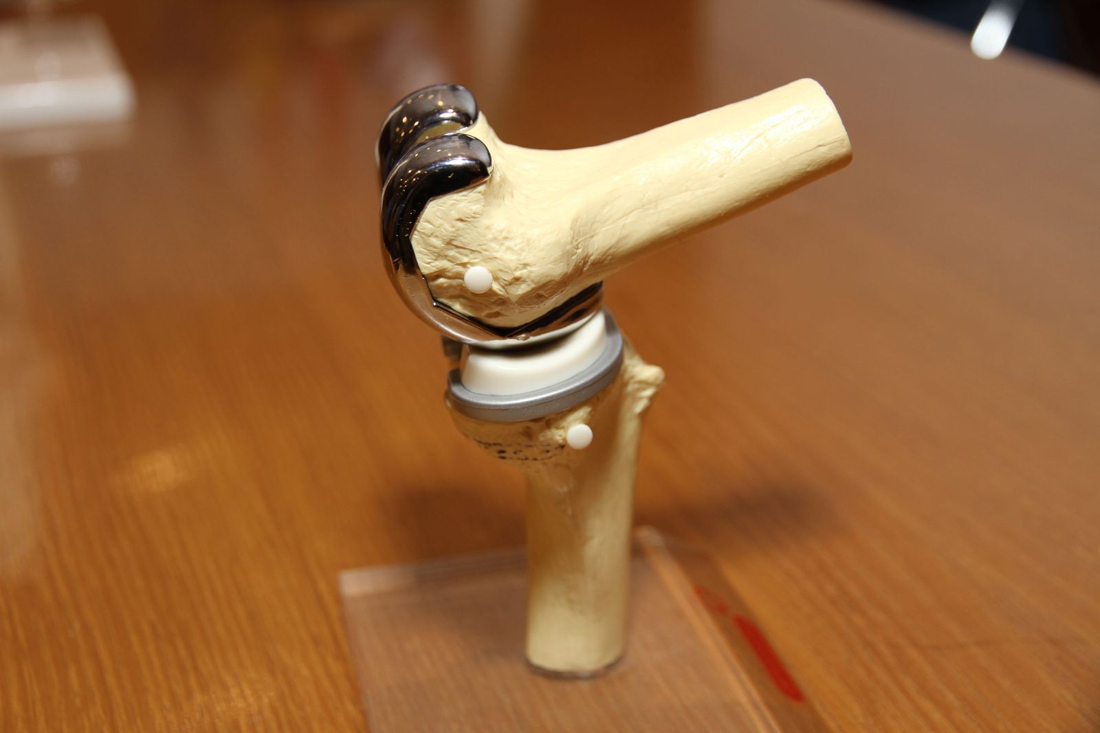 ¿Cuánto dura mi prótesis?