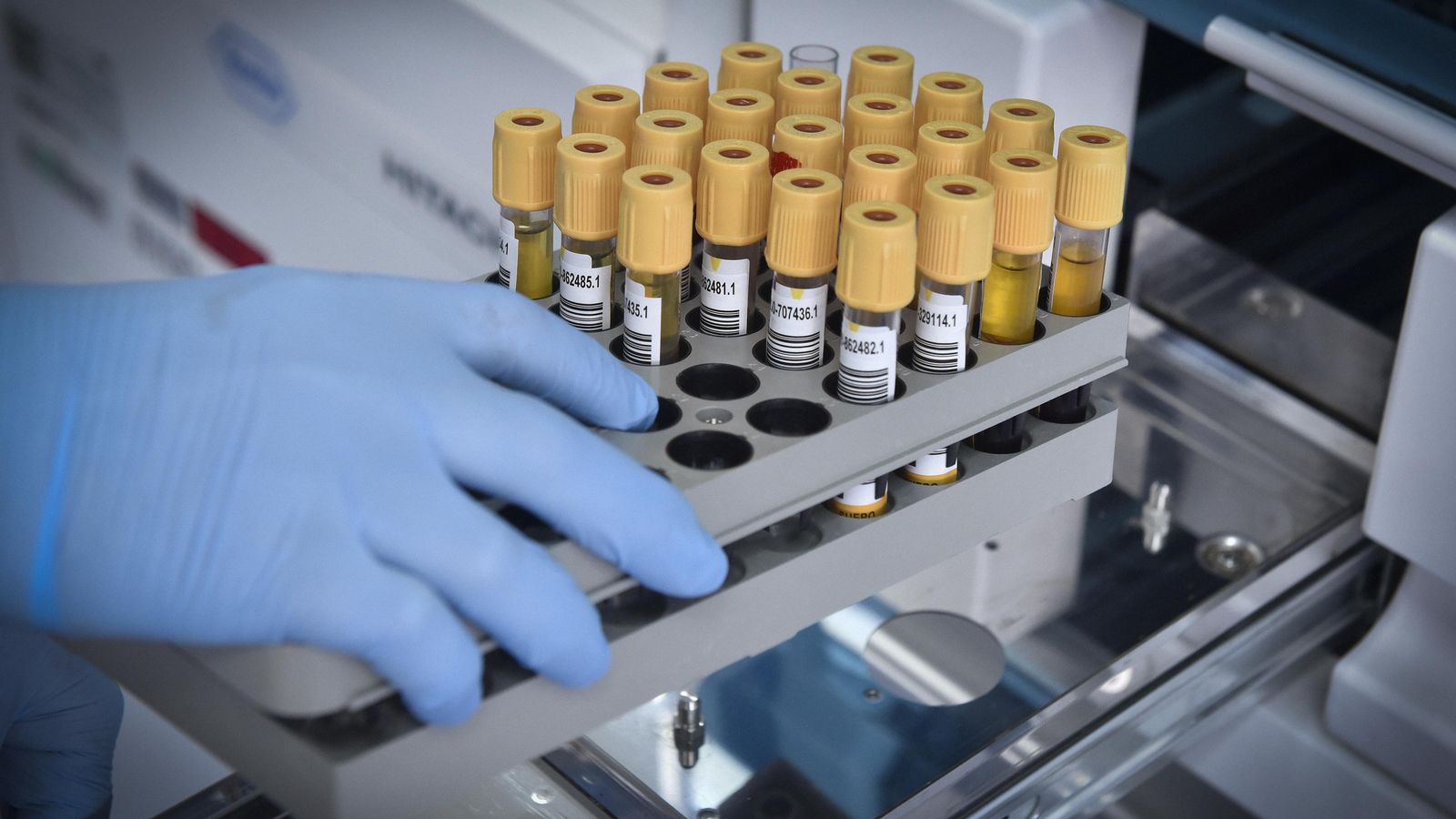 Varias pruebas PCR, listas para su análisis.