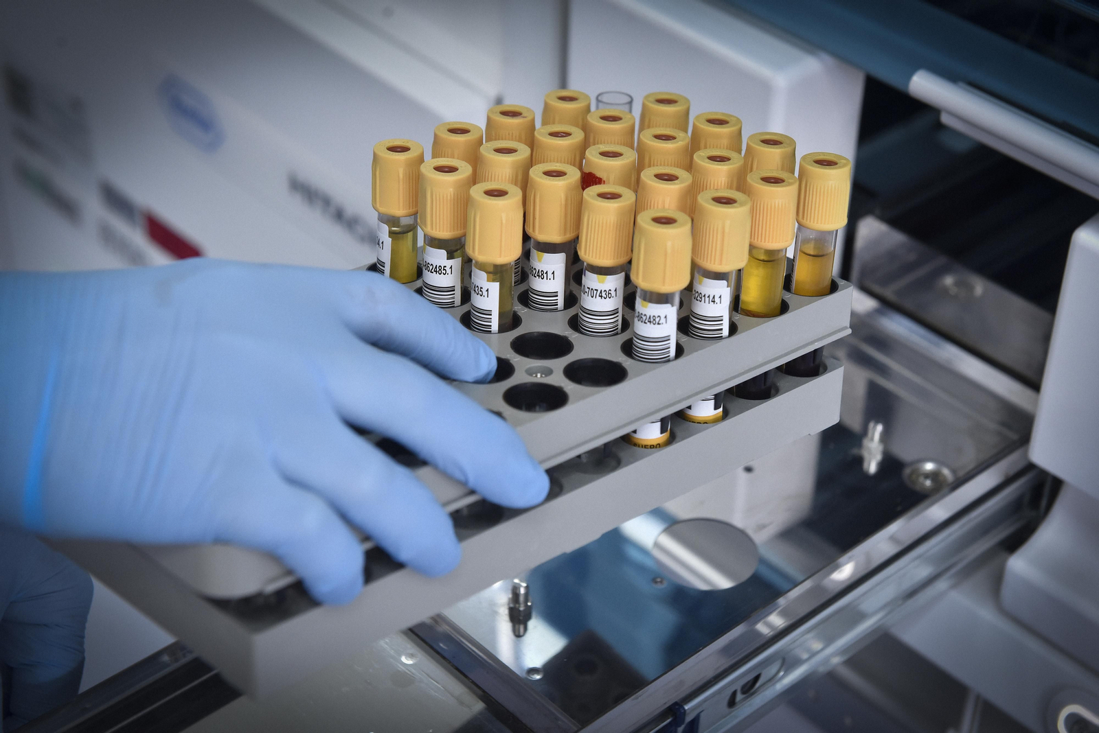 La resistencia en la sanidad andaluza en el Virgen del Rocío: laboratorio general y de urgencias contra el Covid-19