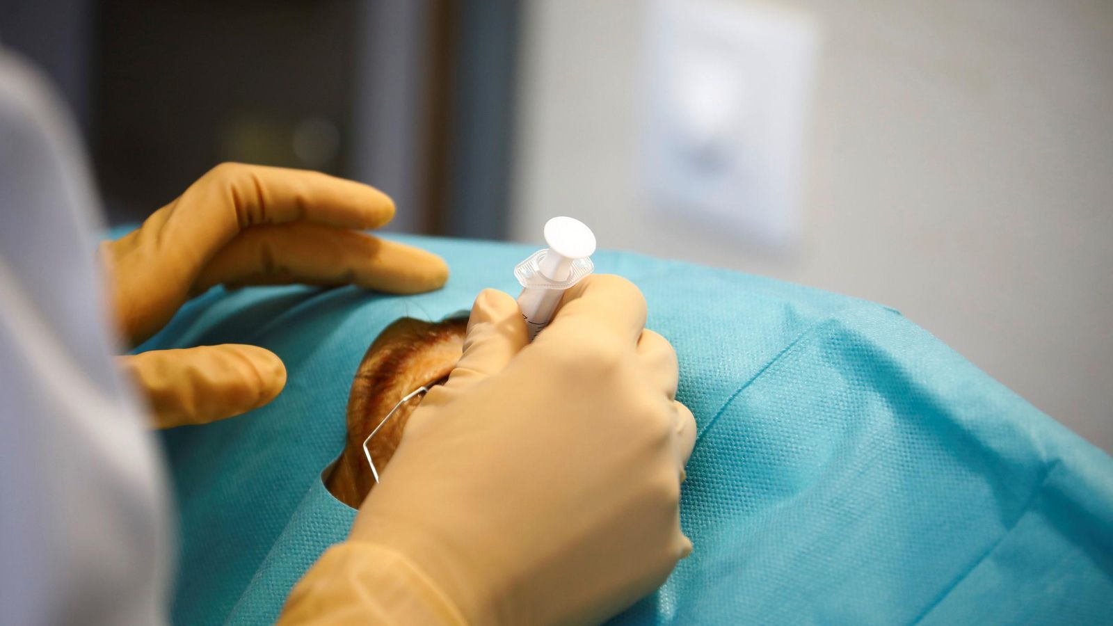 Procedimiento para la inyección intravítrea.