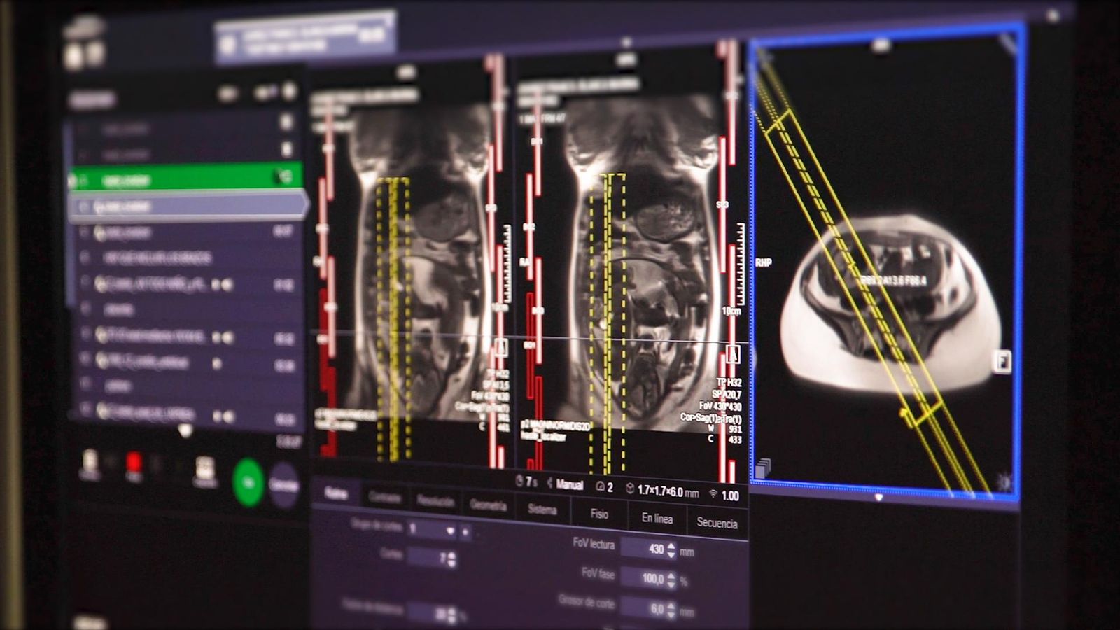 Comprobación clínica del efecto del mindfulness en el feto