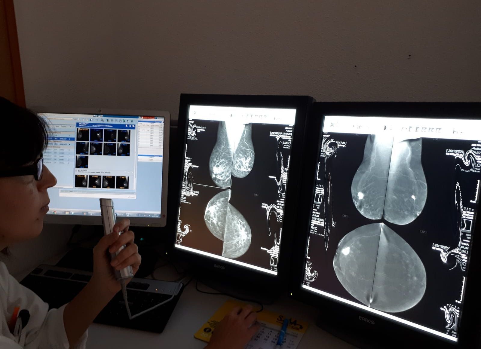 Un miembro del equipo sanitario examina dos de estas mamografías.