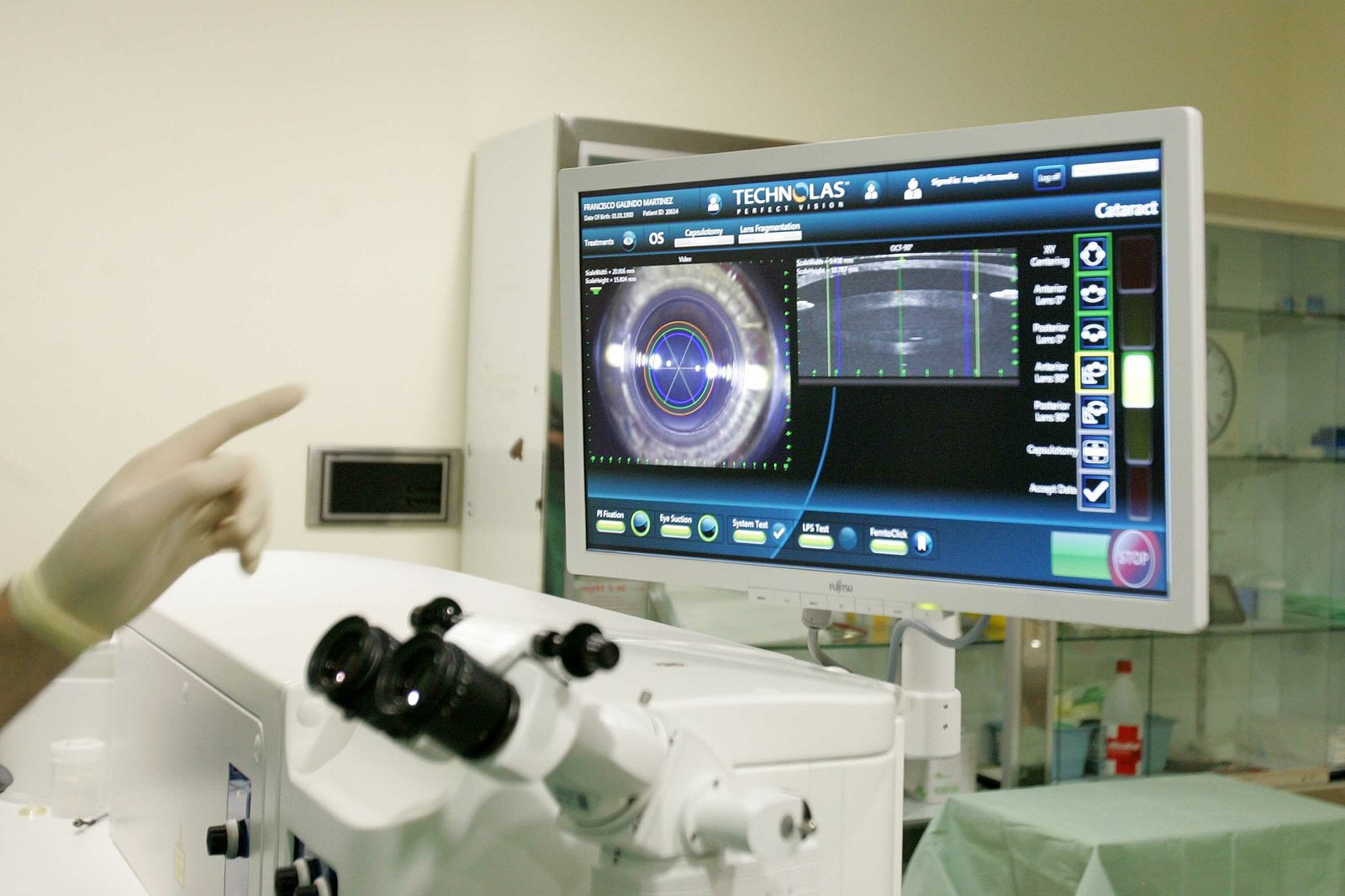 Imagen de archivo de una operación de cataratas