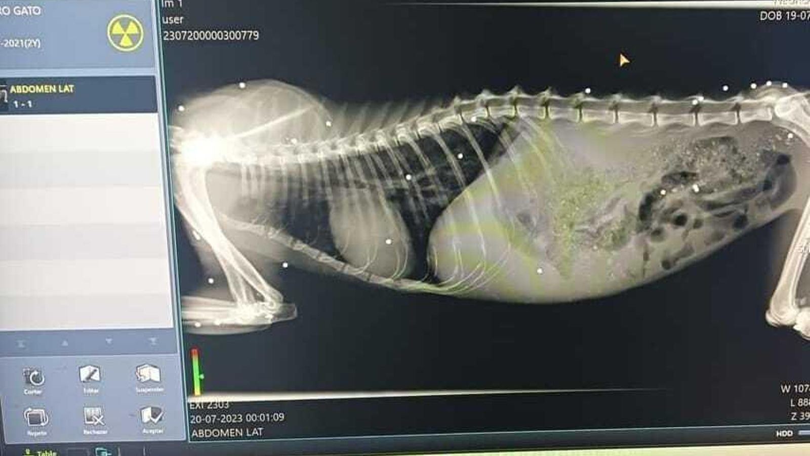 Los puntos blancos son los perdigones detectados en la radiografía