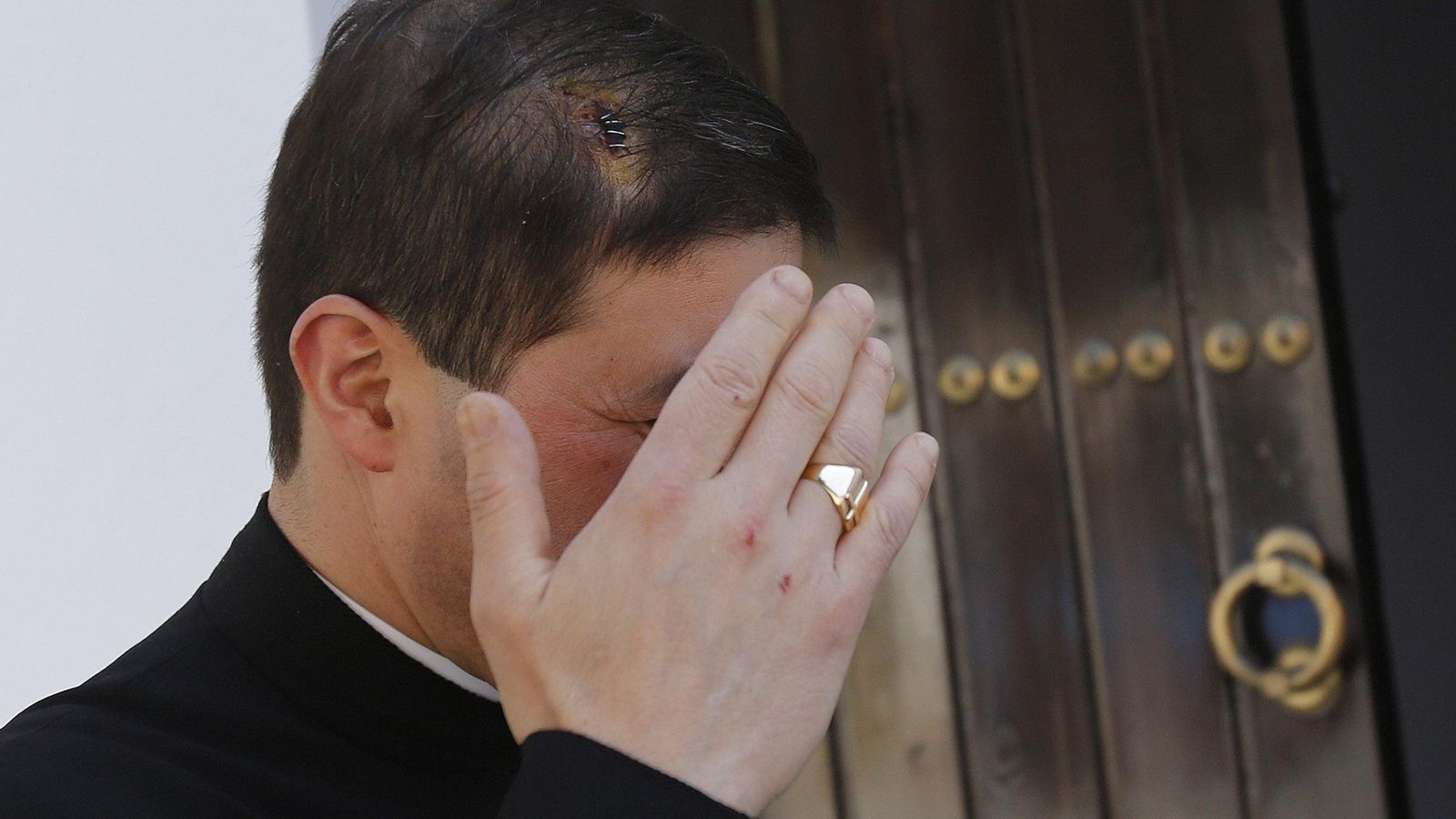 El cura herido, con la brecha en la sien.