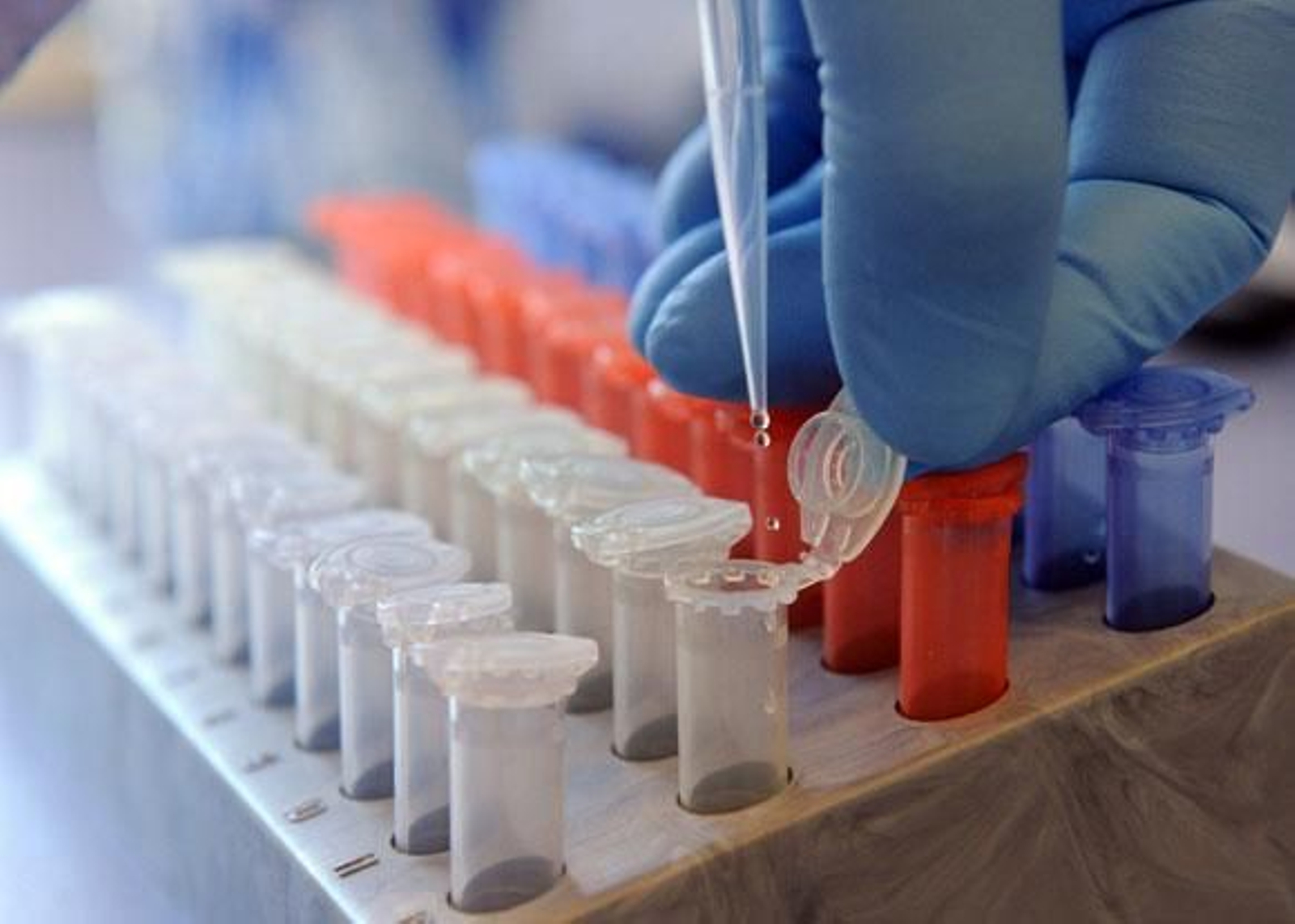 La OMS dice que la E.coli analizada es desconocida