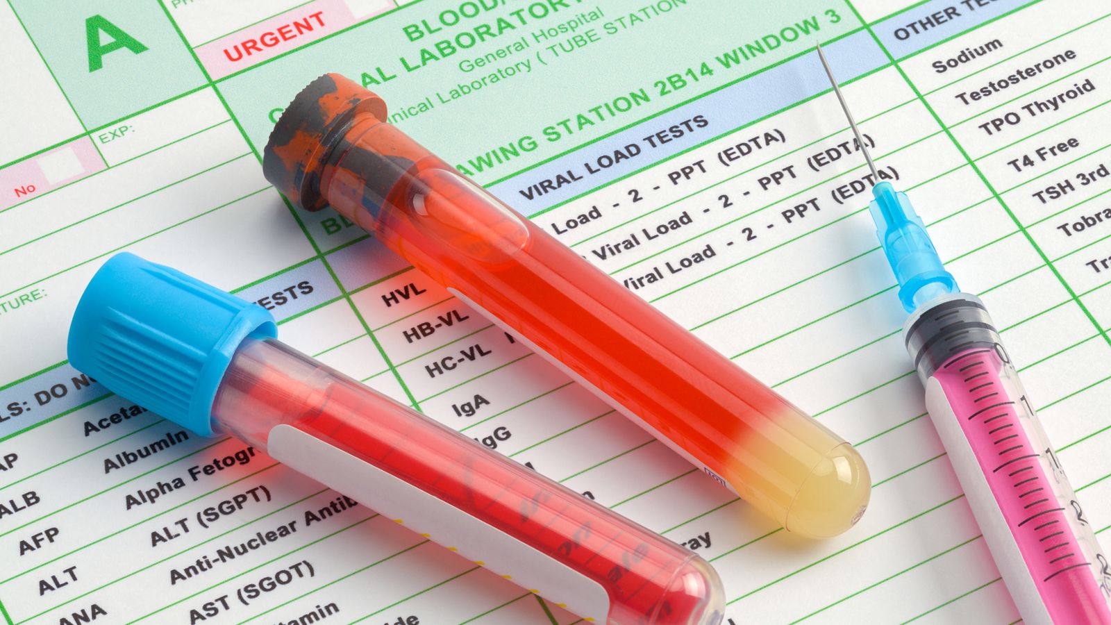 Test para detectar anticuerpos contra la Covid-19.