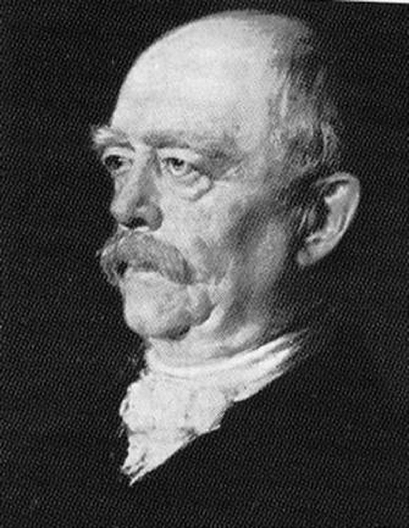 Curiosidades históricas, anécdotas y frases hechasOsteoporosis, enfermedad que afecta a los huesos