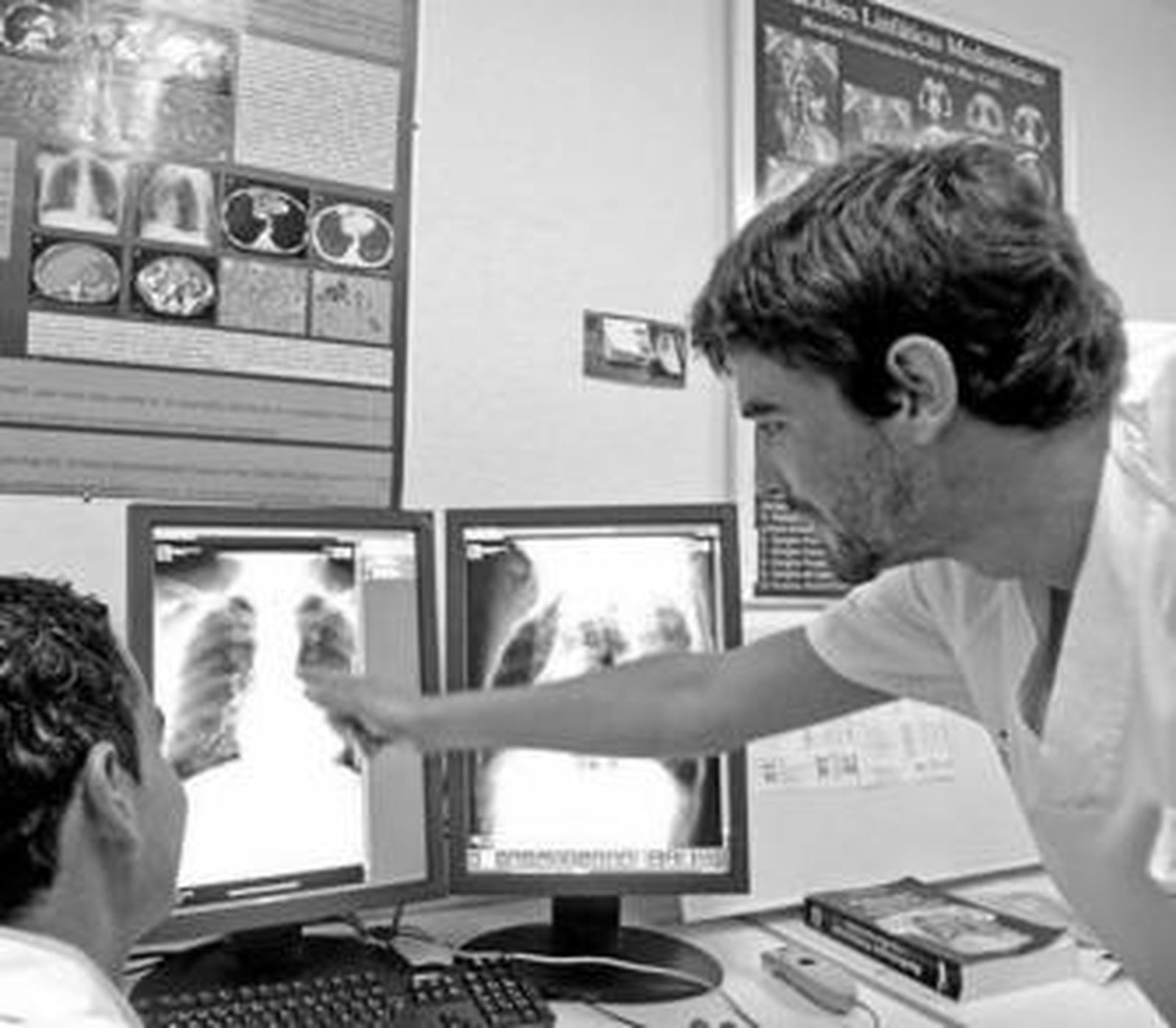 Dos médicos residentes observan la radiografía de un paciente.