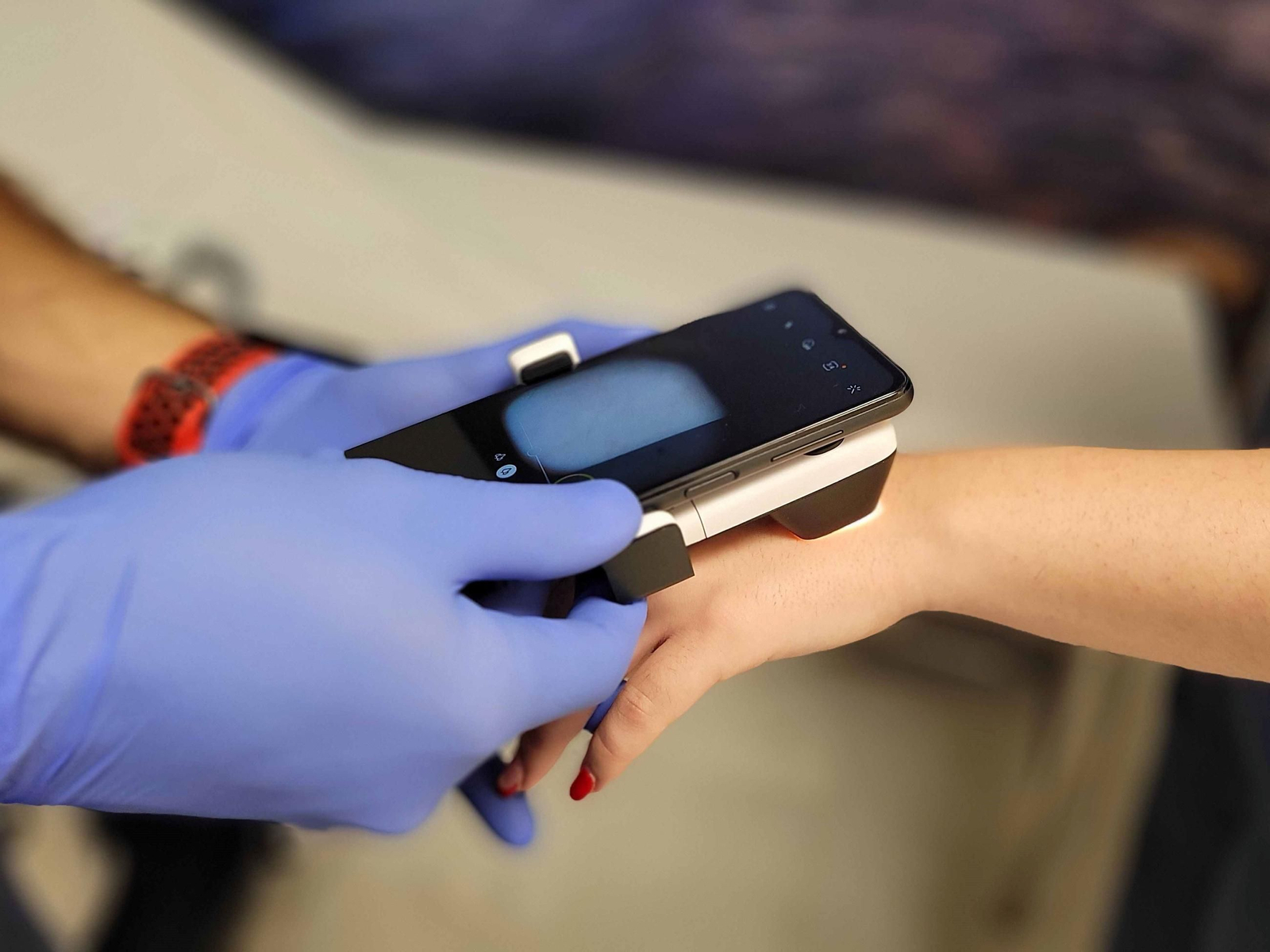 Servicio de teledermatología para revisar lunares irregulares.