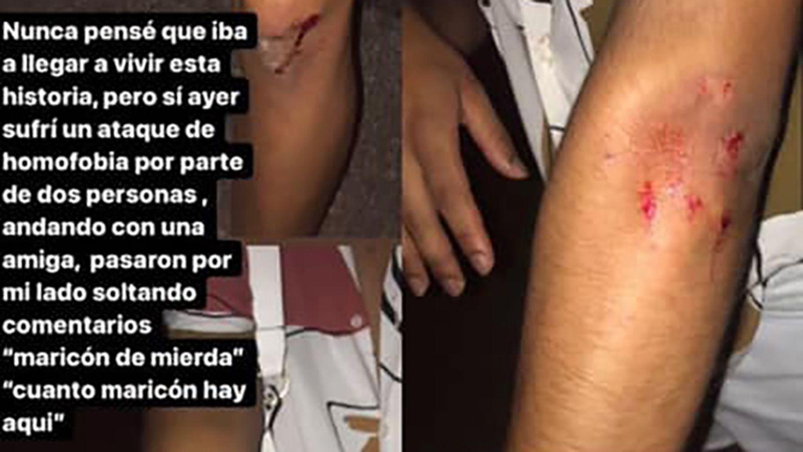 Un joven denuncia una agresión homófoba en Castell de Ferro (Granada)