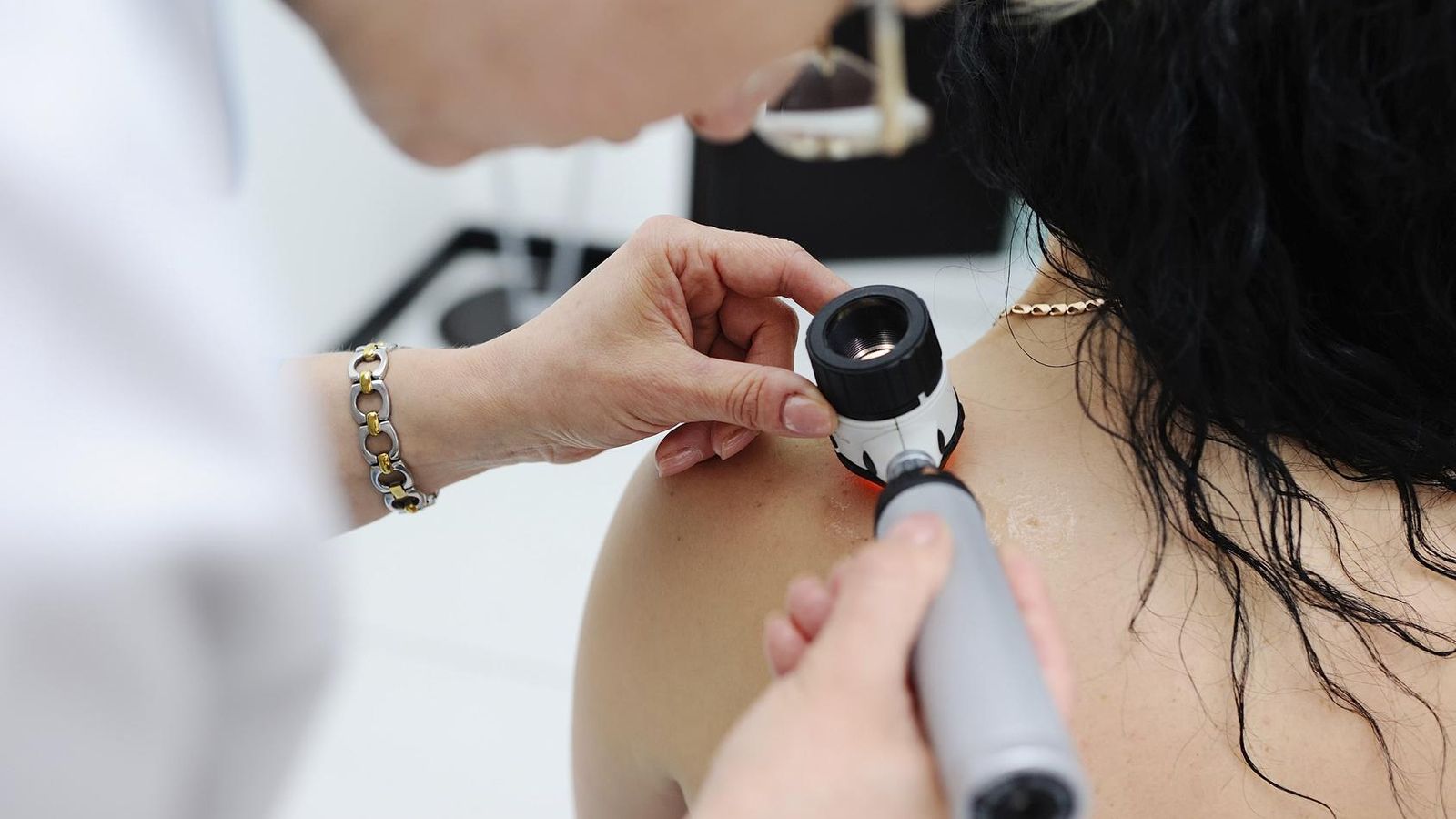 Una médica examina un lunar en hombro.