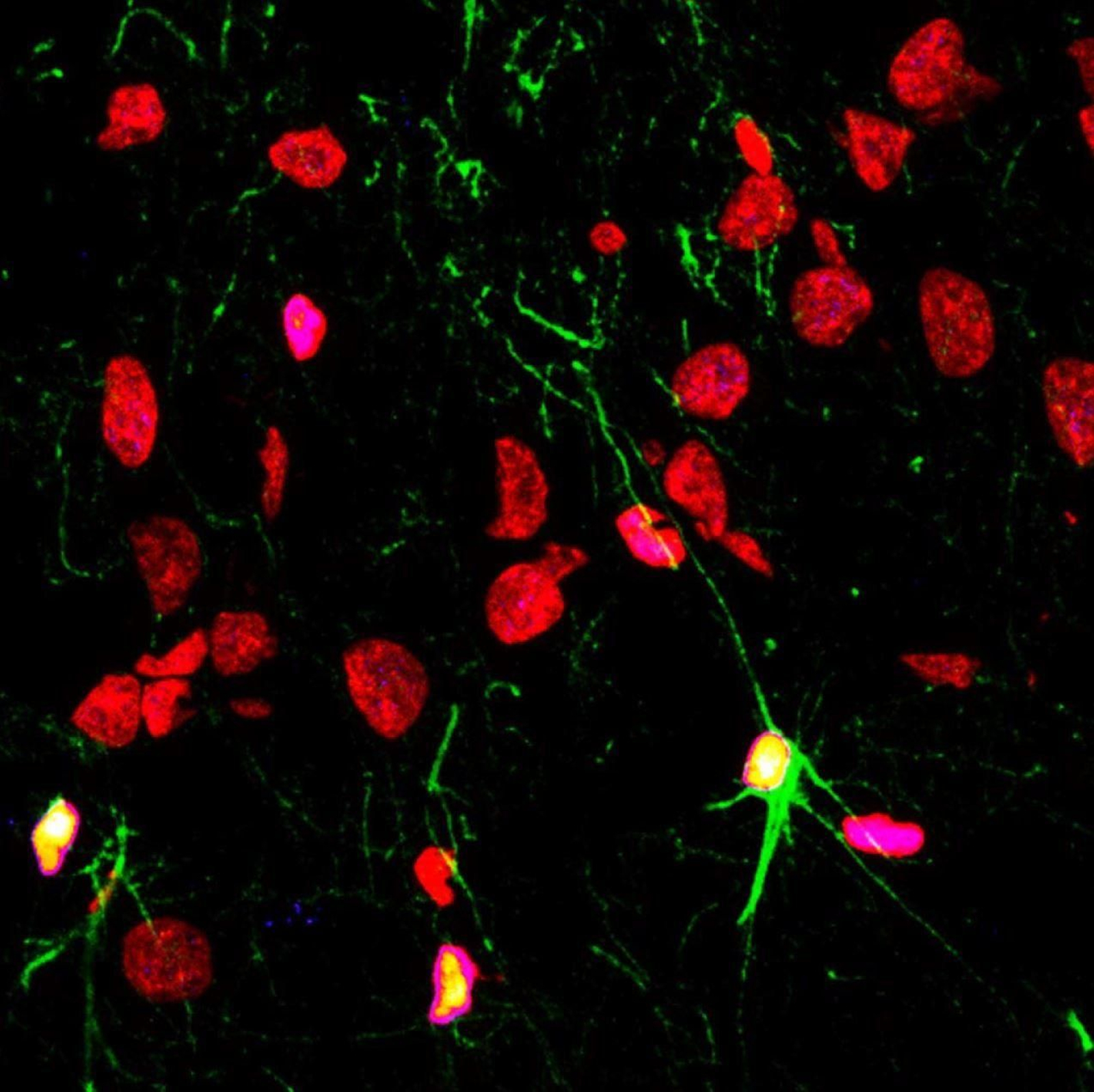 Célula madre en división en el hipocampon de un humano adulto.