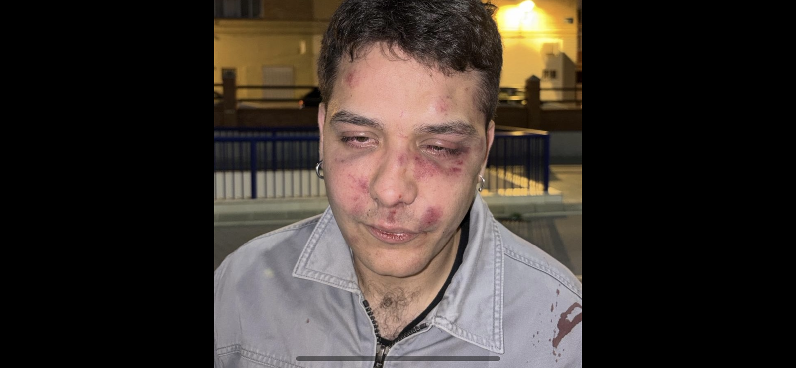 Pablo Romero, joven agredido en Málaga