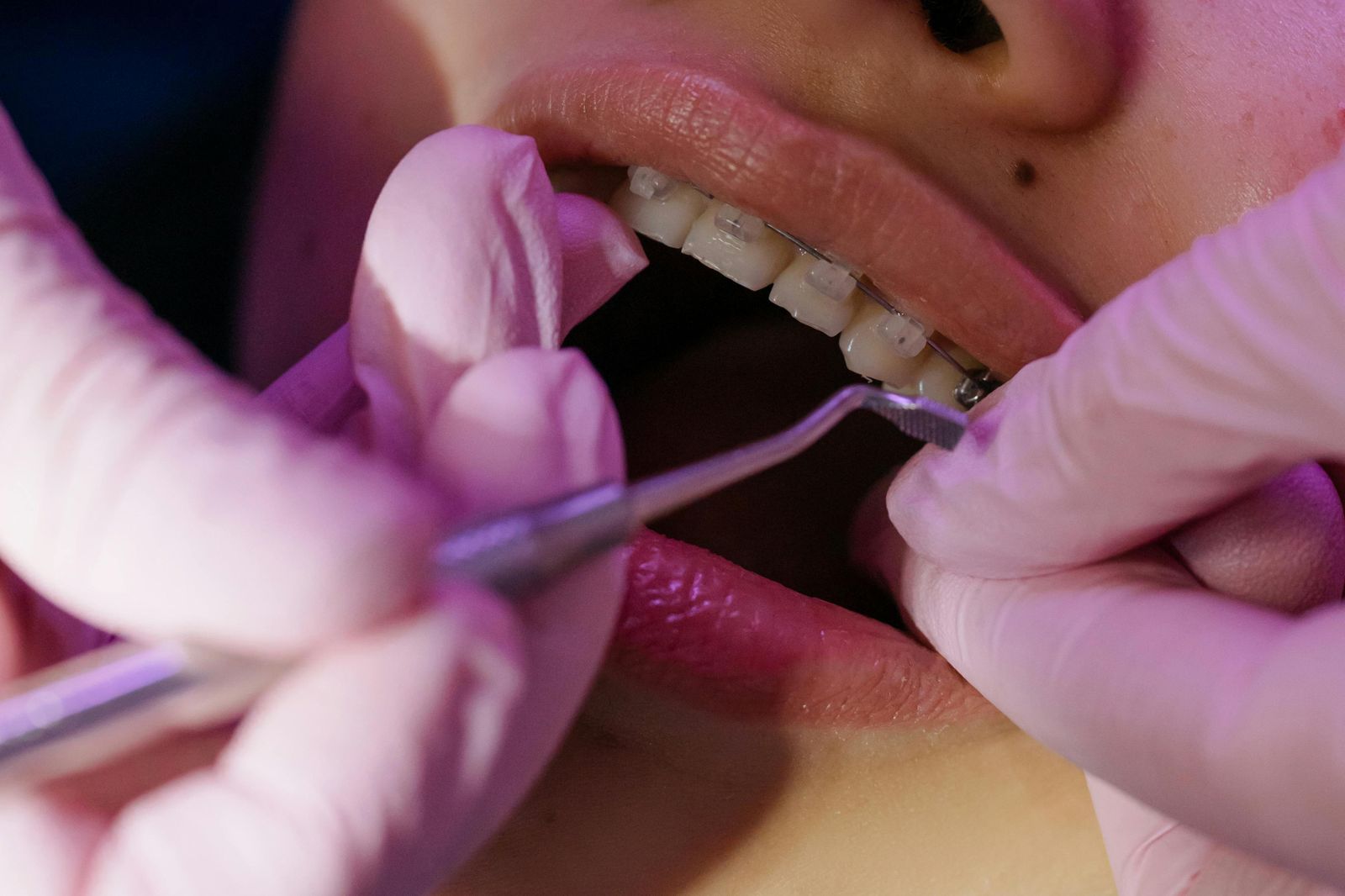 Conoce la ortodoncia: la magnificencia para tus dientes