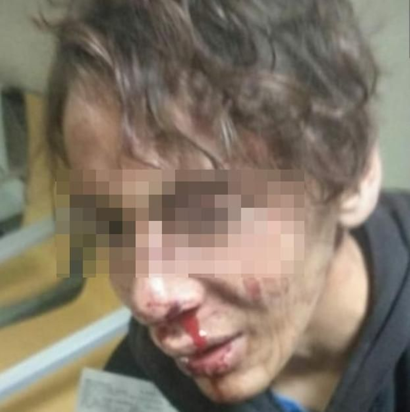 Estado del menor tras la paliza de unos policías en Melilla