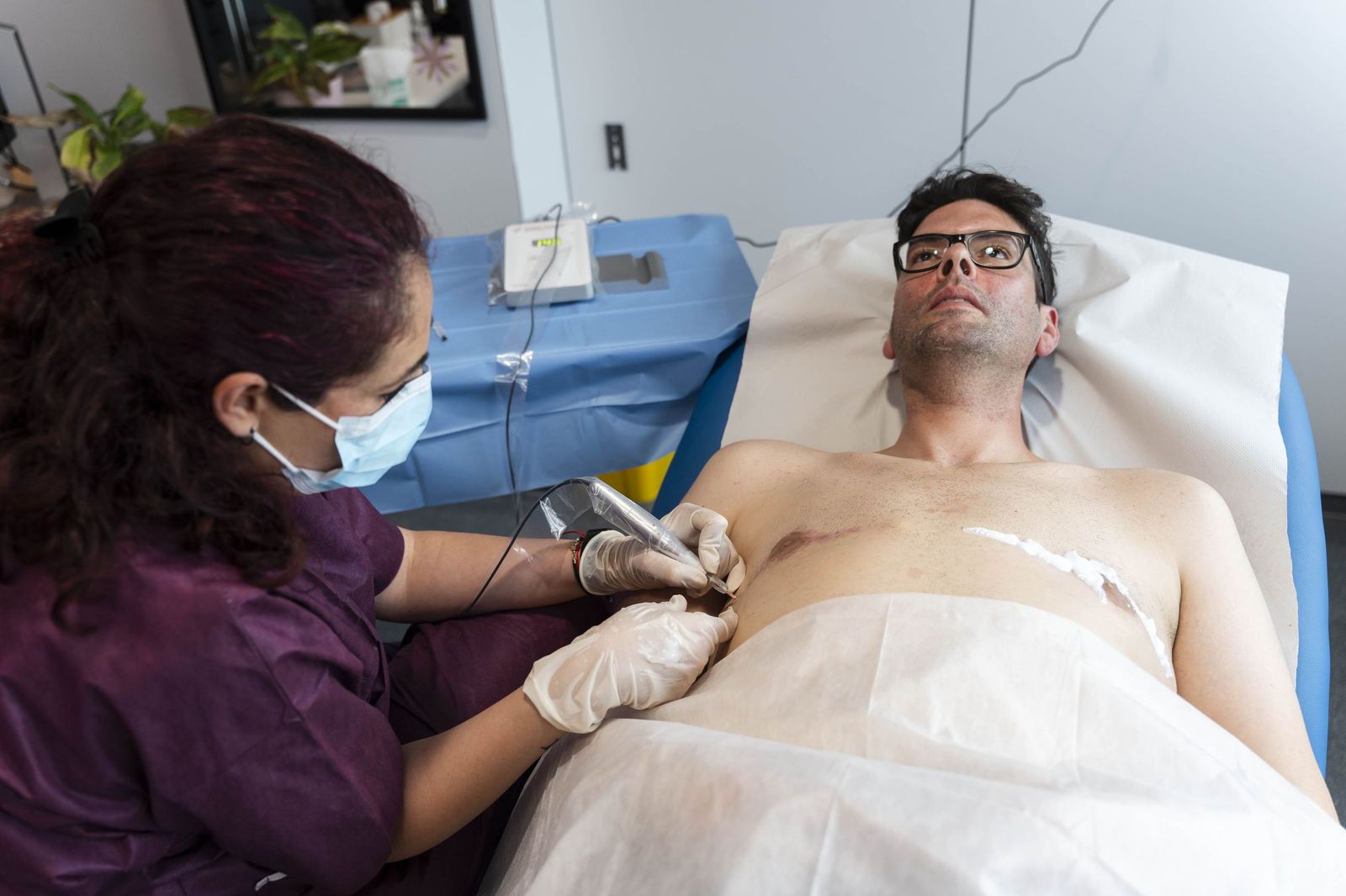 Un tratamiento de micropigmentación por mastectomía en un hombre, en imágenes