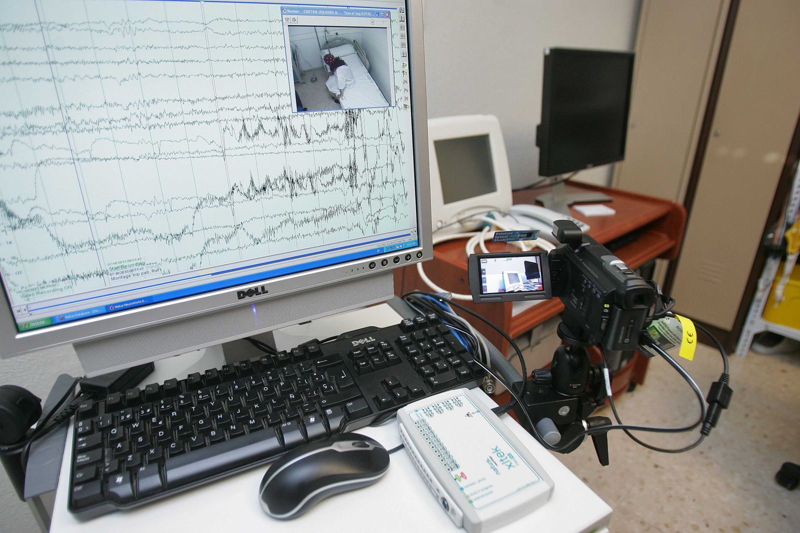 Imagen de archivo de reportaje a la Unidad de Epilepsia del Hospital Universitario Torrecárdenas.