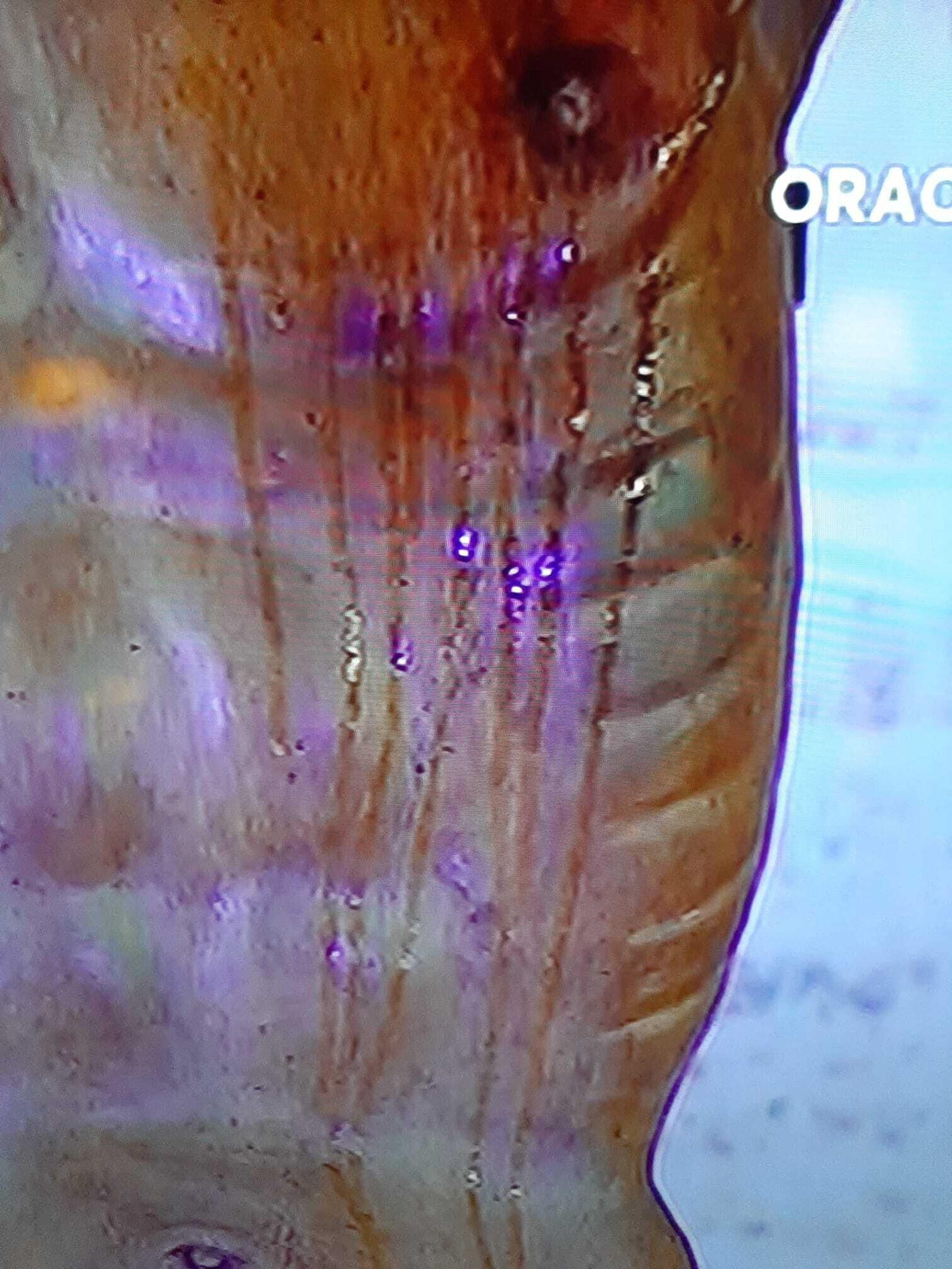 El agua de lluvia sobre el pecho de la sagrada imagen