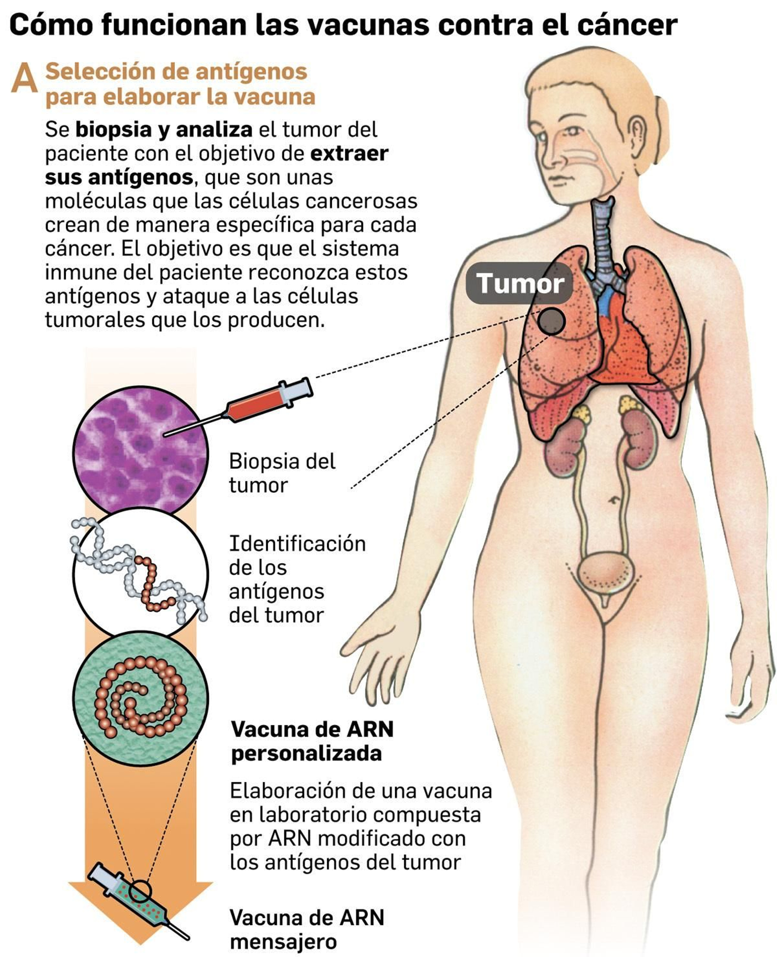 Fuente: Elaboración propia. Gráfico: Dpto. de Infografía