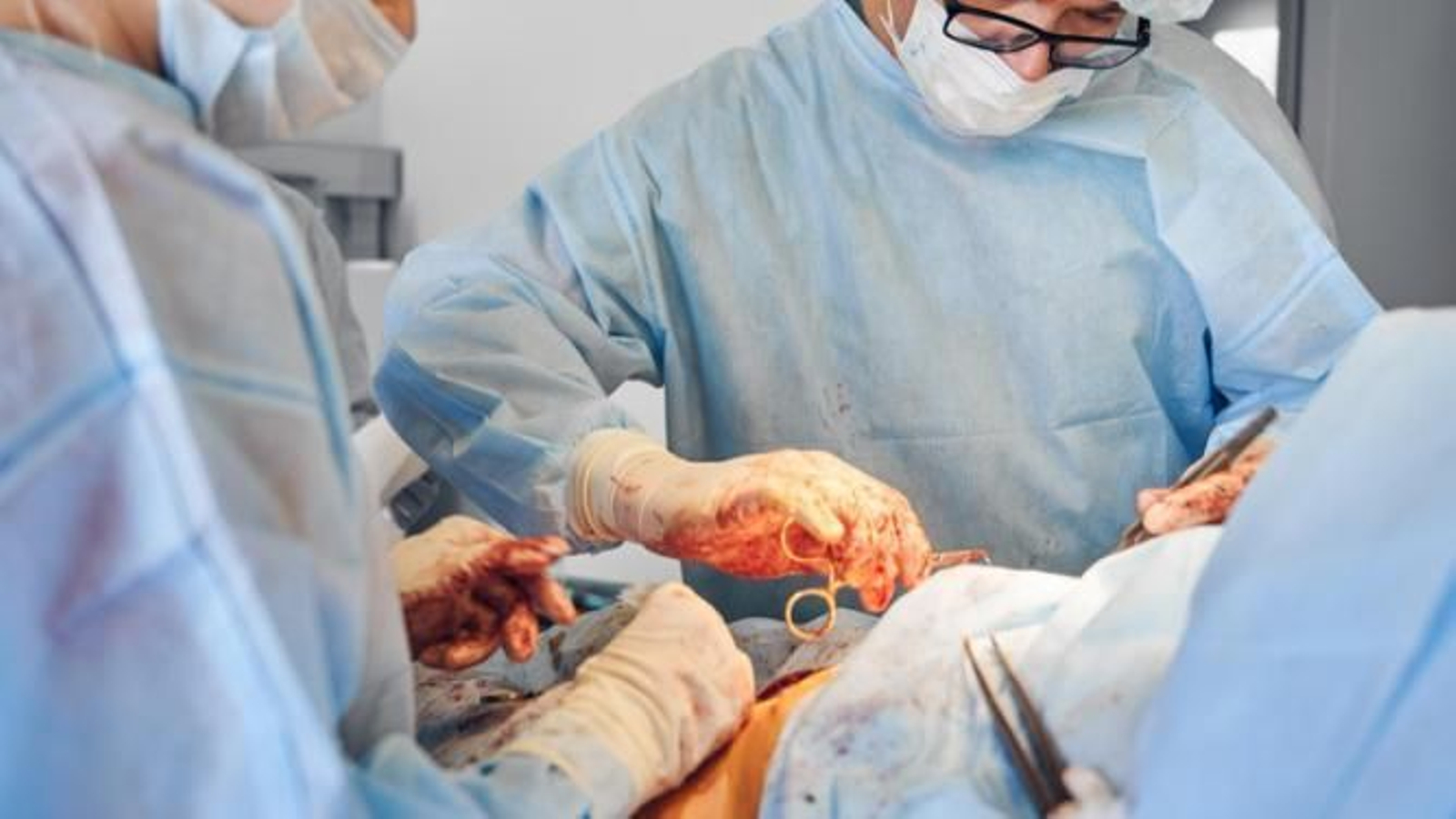 Enfermedades por las que se necesita un trasplante de hígado