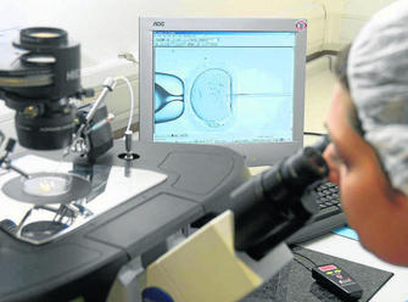 Proceso de fecundación in vitro mediante técnicas de inyección intracitoplasmática.