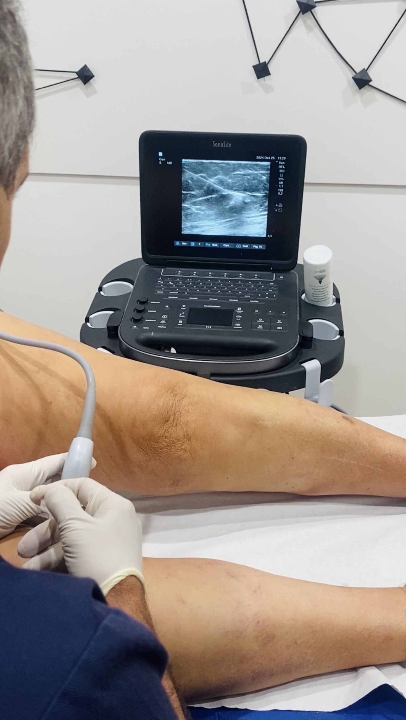 Radiología Intervencionista