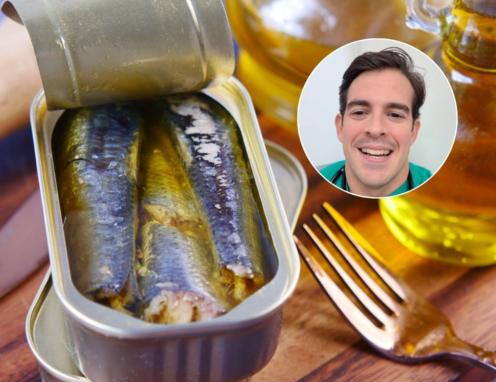 El cardiologo Aurelio Rojas enumera los beneficios de las sardinas.