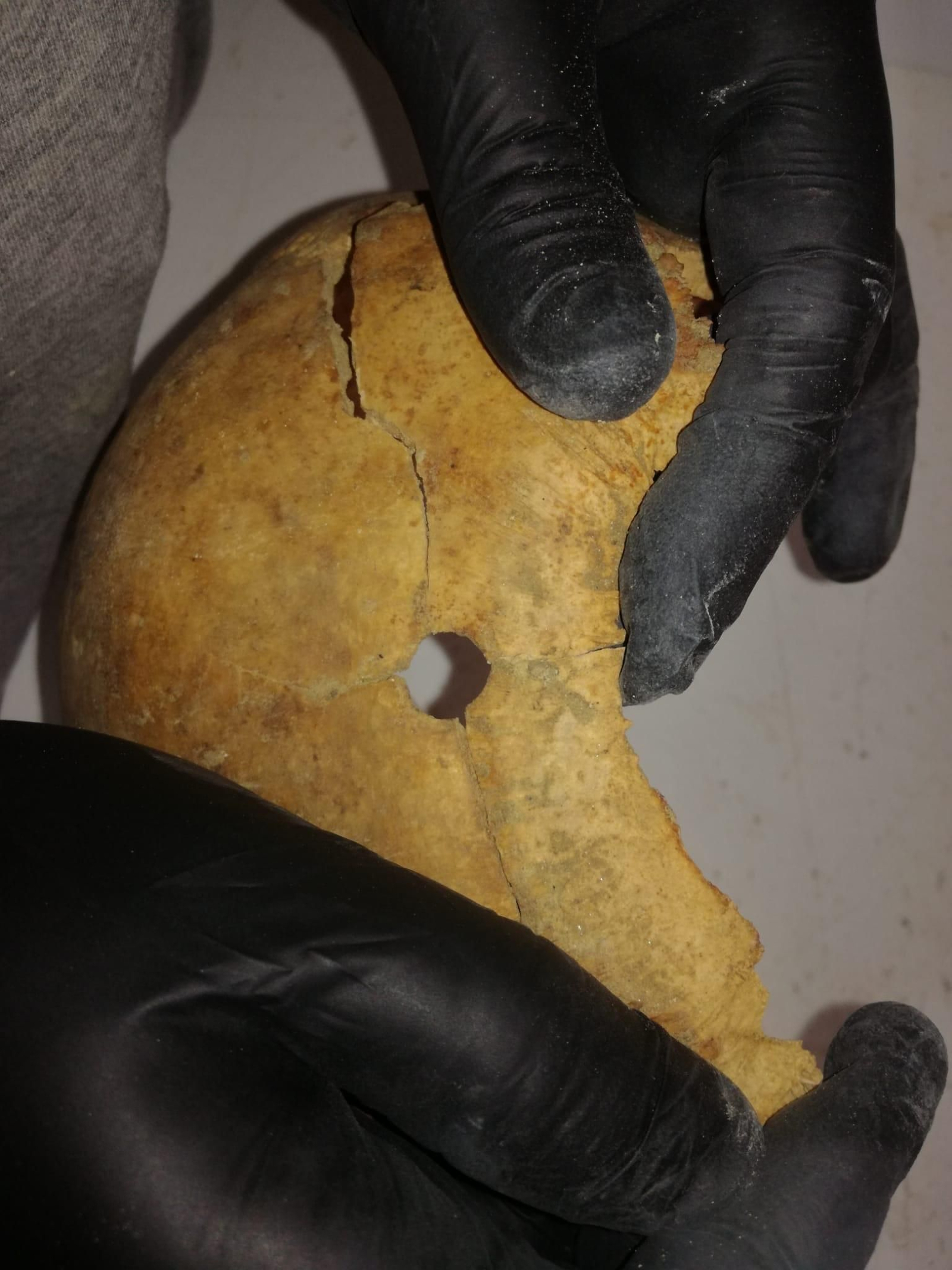 Restos del craneo de una víctima de la represión.