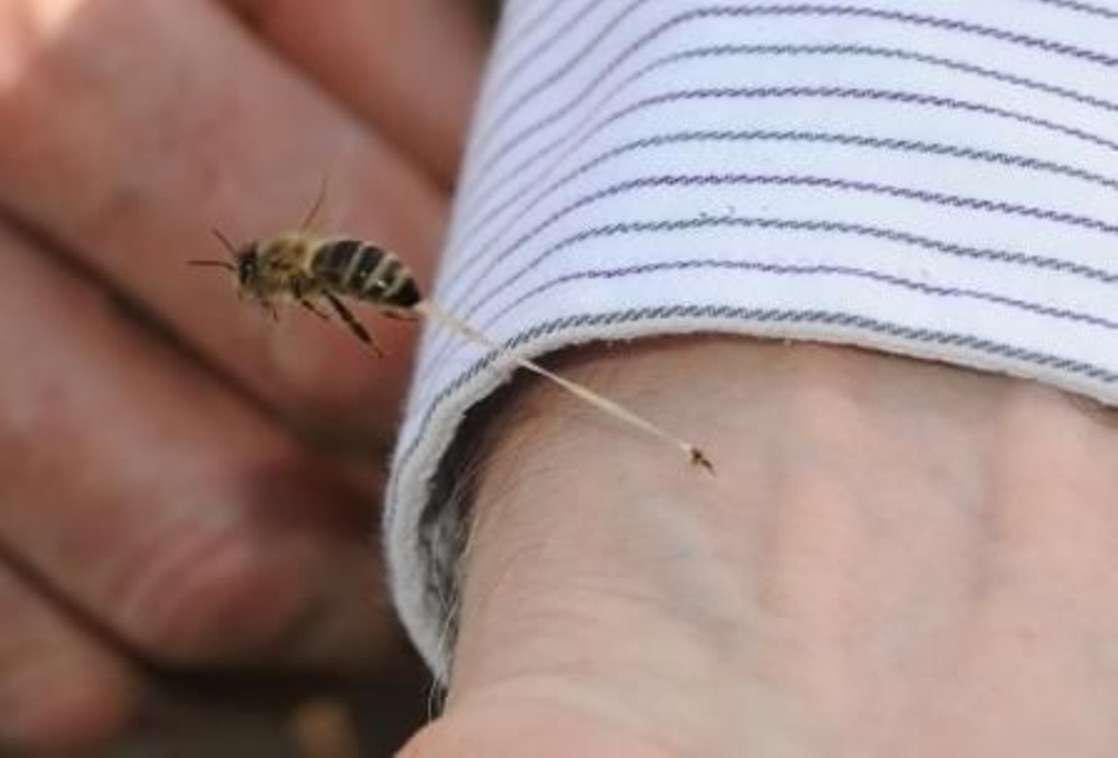 Una picadura de abeja