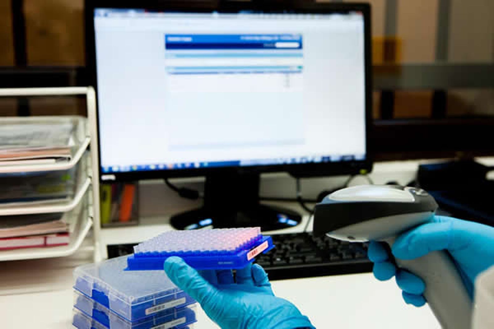 Andalucía lidera 31 proyectos de investigación sobre Alzheimer