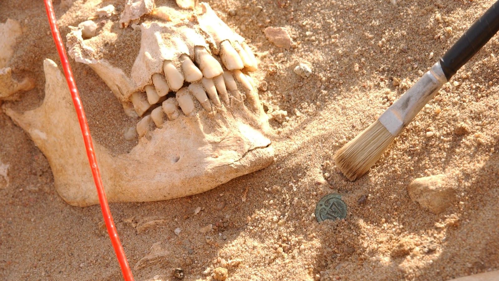 El ejército de Napoleón derrotado en Rusia en 1812 sufrió fiebre paratifoidea y recurrente