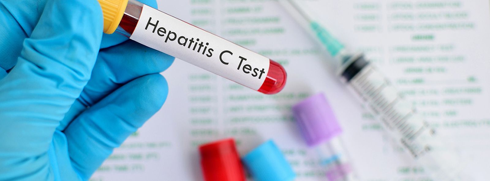 Test de hepatitis C