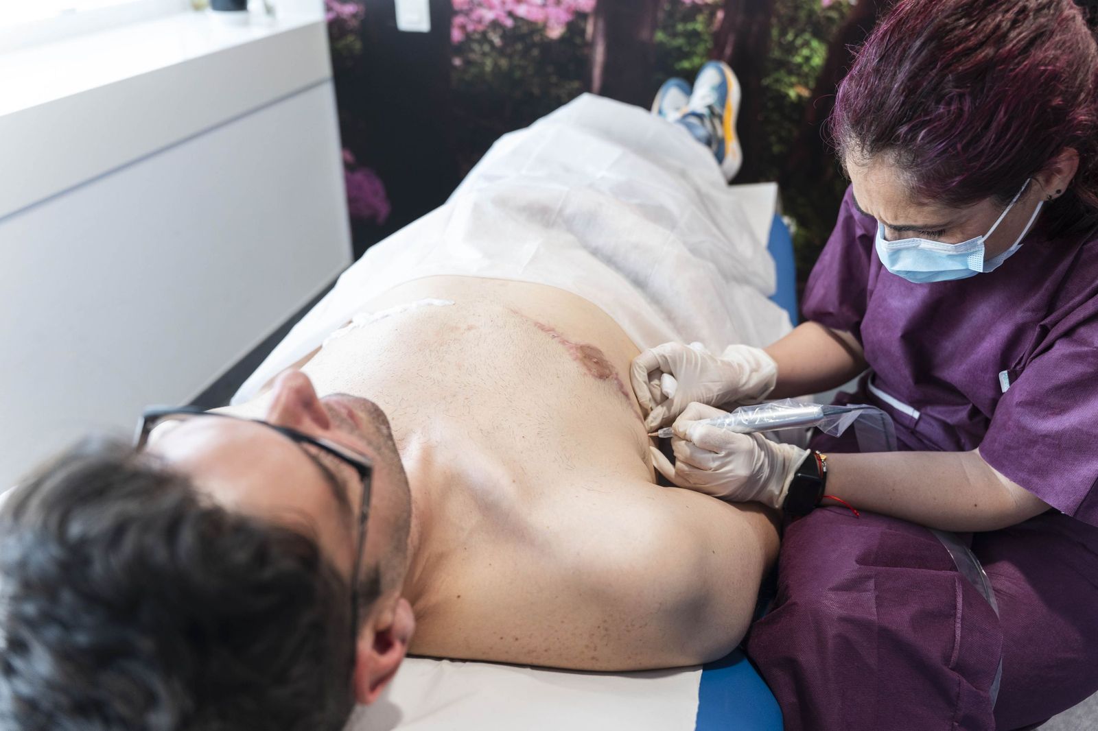 Un tratamiento de micropigmentación por mastectomía en un hombre, en imágenes