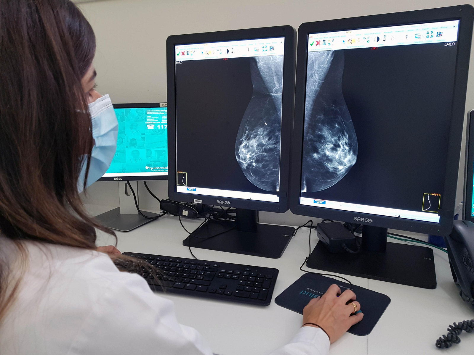 Una sanitaria observa una mamografía.