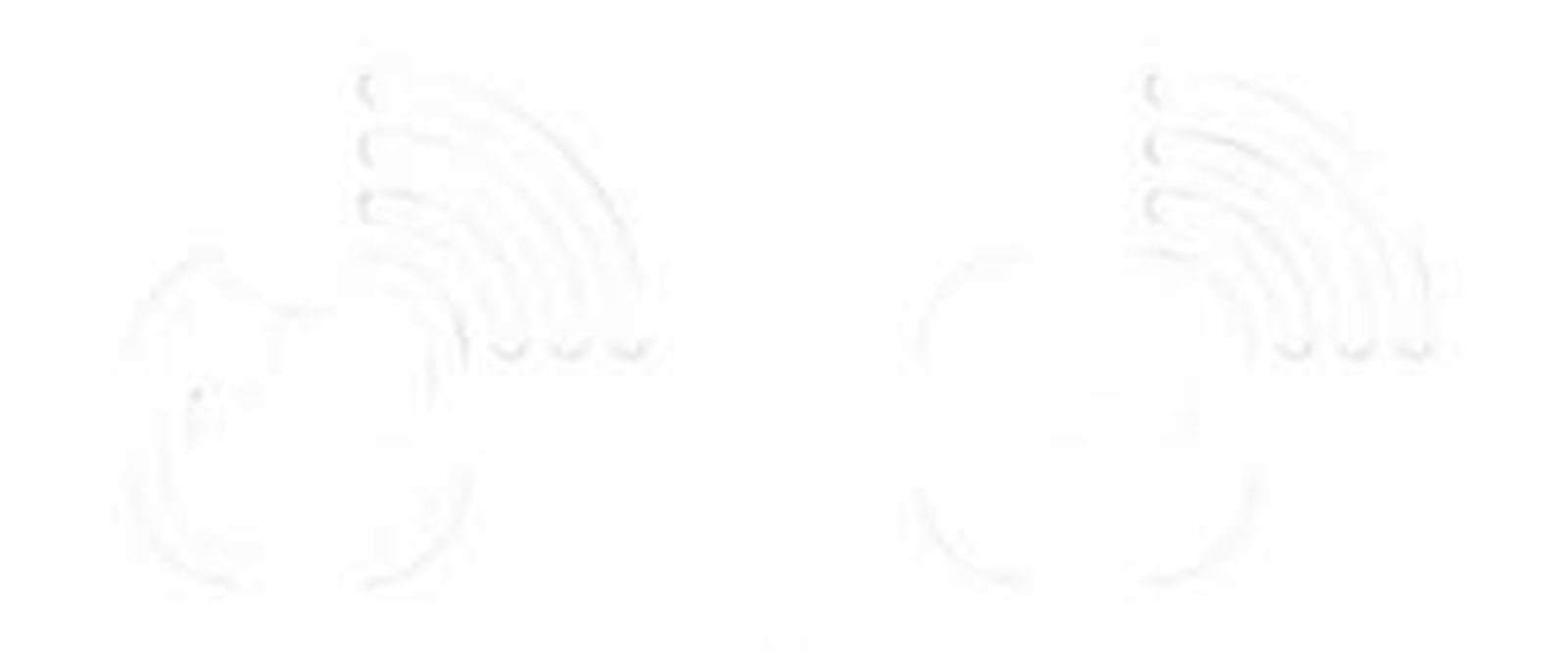 Un Metro sólo circula bajo tierra